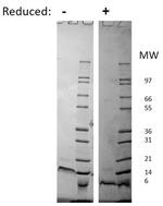 Human CXCL12 (SDF-1a) Protein