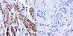 RPA2 Antibody in Immunohistochemistry (Paraffin) (IHC (P))