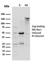 IL-10R1 (Interleukin-10 Receptor 1) (CD210) Antibody in SDS-PAGE (SDS-PAGE)