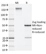 IL-4 (Interleukin-4) Antibody in SDS-PAGE (SDS-PAGE)