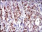 RUNX3 Antibody in Immunohistochemistry (Paraffin) (IHC (P))