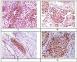 RAB25 Antibody in Immunohistochemistry (Paraffin) (IHC (P))