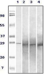 RAB25 Antibody in Western Blot (WB)