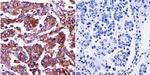 Pan Ras Antibody in Immunohistochemistry (Paraffin) (IHC (P))