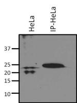 RhoA/RhoC Antibody in Immunoprecipitation (IP)