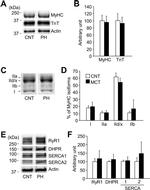 SERCA2 ATPase Antibody in Western Blot (WB)