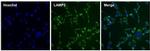 Rat IgG (H+L) Cross-Adsorbed Secondary Antibody in Immunocytochemistry (ICC/IF)