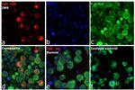 Human IgG Fc Cross-Adsorbed Secondary Antibody in Immunocytochemistry (ICC/IF)