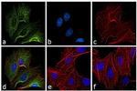 Rat IgG (H+L) Cross-Adsorbed Secondary Antibody in Immunocytochemistry (ICC/IF)