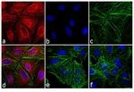 Rat IgG (H+L) Cross-Adsorbed Secondary Antibody in Immunocytochemistry (ICC/IF)