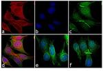 Mouse IgG (H+L) Cross-Adsorbed Secondary Antibody in Immunocytochemistry (ICC/IF)