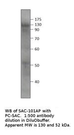 Soluble Adenylate Cyclase 1 Antibody in Western Blot (WB)