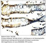 SEC24B Antibody in Immunohistochemistry (IHC)