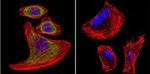 SERCA1 ATPase Antibody in Immunocytochemistry (ICC/IF)