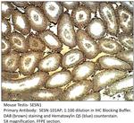 SESN1 Antibody in Immunohistochemistry (IHC)