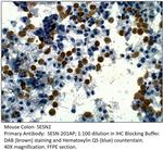 SESN2 Antibody in Immunohistochemistry (IHC)