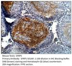 SFRP5 Antibody in Immunohistochemistry (IHC)