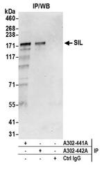 SIL Antibody in Western Blot (WB)