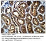 SIRT5 Antibody in Immunohistochemistry (IHC)