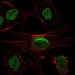 SIRT1 Antibody in Immunocytochemistry (ICC/IF)