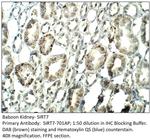 SIRT7 Antibody in Immunohistochemistry (IHC)