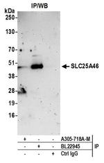 SLC25A46 Antibody in Immunoprecipitation (IP)