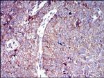 GLUT4 Antibody in Immunohistochemistry (Paraffin) (IHC (P))