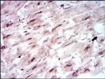 GLUT4 Antibody in Immunohistochemistry (Paraffin) (IHC (P))