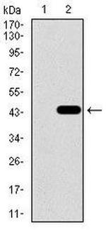 GLUT4 Antibody in Western Blot (WB)