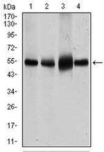 GLUT4 Antibody in Western Blot (WB)