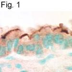 EBP50 Antibody in Immunohistochemistry (IHC)