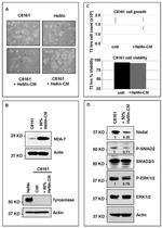 Phospho-SMAD2 (Ser465, Ser467) Antibody in Western Blot (WB)