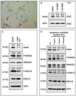 Phospho-SMAD2 (Ser465, Ser467) Antibody in Western Blot (WB)