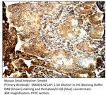 Smad4 Antibody in Immunohistochemistry (IHC)