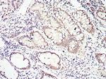 SMAD4 Antibody in Immunohistochemistry (Paraffin) (IHC (P))