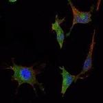 SMAD5 Antibody in Immunocytochemistry (ICC/IF)