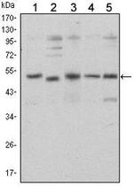 SMAD5 Antibody in Western Blot (WB)