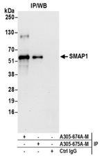 SMAP1 Antibody in Western Blot (WB)