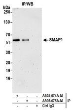 SMAP1 Antibody in Western Blot (WB)