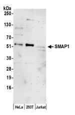 SMAP1 Antibody in Western Blot (WB)