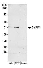 SMAP1 Antibody in Western Blot (WB)