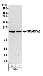 SMARCA3 Antibody in Western Blot (WB)