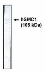 SMC1 Antibody in Western Blot (WB)