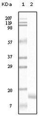 gamma Synuclein Antibody in Western Blot (WB)