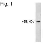 SNTB2 Antibody in Western Blot (WB)