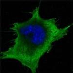 SOD1 Antibody in Immunocytochemistry (ICC/IF)