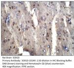 SOX10 Antibody in Immunohistochemistry (IHC)