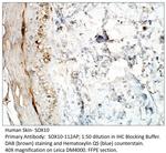 SOX10 Antibody in Immunohistochemistry (IHC)