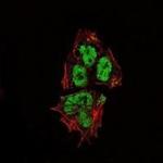 SOX2 Antibody in Immunocytochemistry (ICC/IF)