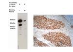 SPARC Antibody in Immunohistochemistry (IHC)